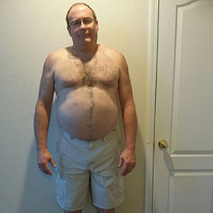 Adrian B Before