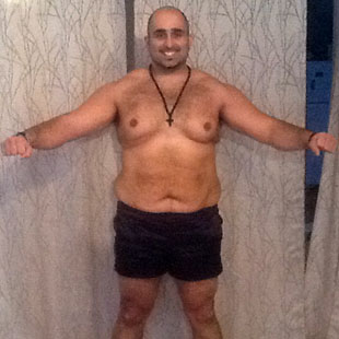 Lazaros X After