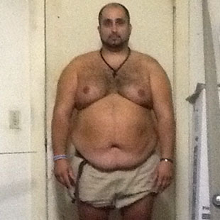 Lazaros X Before