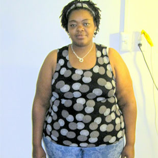Lisa W Before