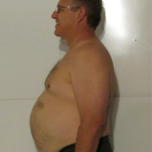 Michael B Before
